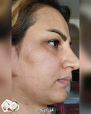 کرم ضد لک و جوانساز ژل رویال