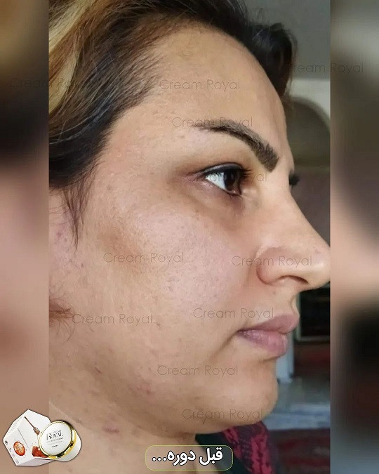 کرم ضد لک و جوانساز ژل رویال