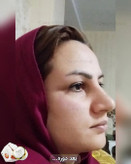 کرم ضد لک و جوانساز ژل رویال